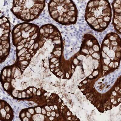 Immunohistochemistry-Paraffin: Casein Kinase 1 gamma 2 Antibody [NBP1-84461]