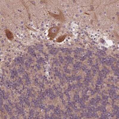 Immunohistochemistry-Paraffin: Casein Kinase 1 gamma 2 Antibody [NBP2-49232]