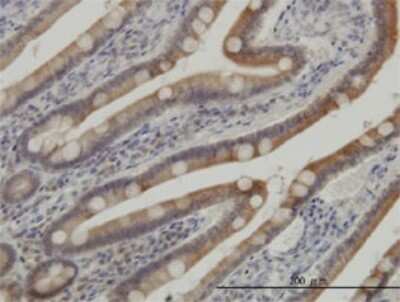 Immunohistochemistry-Paraffin: Casein Kinase 1 gamma Antibody (2E10) [H00053944-M02]