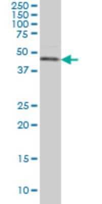 Western Blot: Casein Kinase 1 gamma Antibody (2E10) [H00053944-M02]