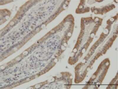 Immunohistochemistry-Paraffin: Casein Kinase 1 gamma Antibody (3D1) [H00053944-M01]