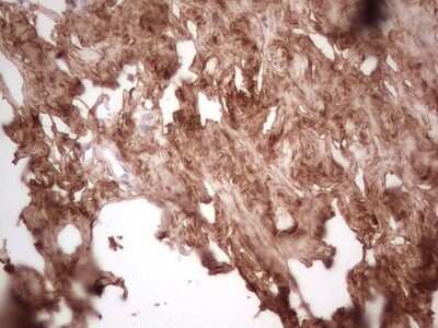 Immunohistochemistry: Casein Kinase 1 gamma Antibody (OTI4D9) [NBP2-46384]