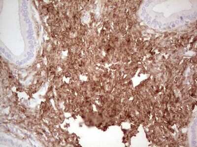 Immunohistochemistry: Casein Kinase 1 gamma Antibody (OTI4D9) [NBP2-46384]