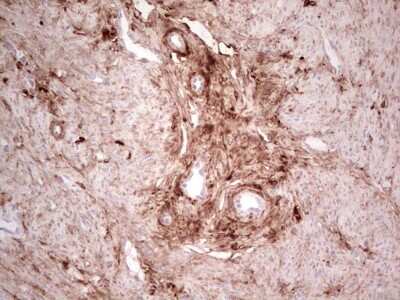 Immunohistochemistry: Casein Kinase 1 gamma Antibody (OTI4D9) [NBP2-46384]