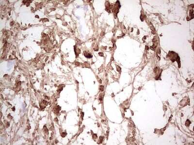 Immunohistochemistry: Casein Kinase 1 gamma Antibody (OTI4D9) [NBP2-46384]