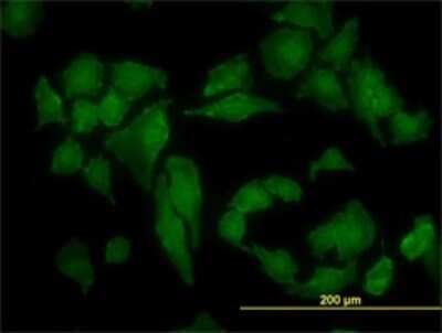 Immunocytochemistry/ Immunofluorescence: Casein Kinase 2 alpha Antibody (3D9) [H00001457-M01]