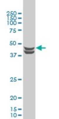 Western Blot: Casein Kinase 2 alpha Antibody (3D9) [H00001457-M01]