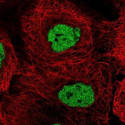 Immunocytochemistry/ Immunofluorescence: Casein Kinase 2 alpha Antibody [NBP2-57124]