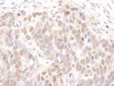 Immunohistochemistry-Paraffin: Casein Kinase 2 alpha Antibody [NB100-378]