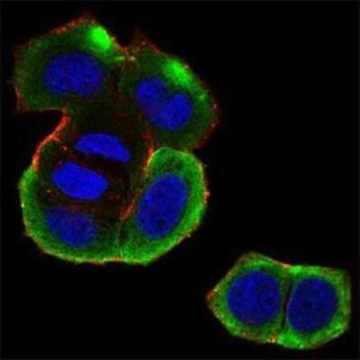 Immunocytochemistry/ Immunofluorescence: Casein Kinase 2 beta Antibody (2F12F3) - BSA Free [NBP2-52449]