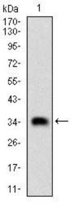 Western Blot: Casein Kinase 2 beta Antibody (2F12F3)BSA Free [NBP2-52449]