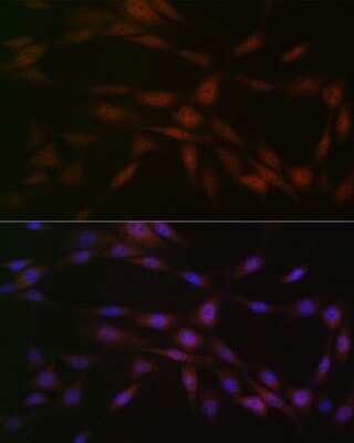 Immunocytochemistry/ Immunofluorescence: Casein Kinase 2 beta Antibody (9T5J10) [NBP3-16264]