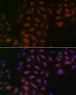 Immunocytochemistry/ Immunofluorescence: Casein Kinase 2 beta Antibody (9T5J10) [NBP3-16264]