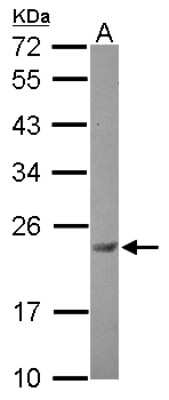 Western Blot: Casein Kinase 2 beta Antibody [NBP2-21570]