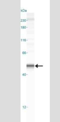 Detection of Caspase-1 in HeLa Cell Lysate by Simple Western