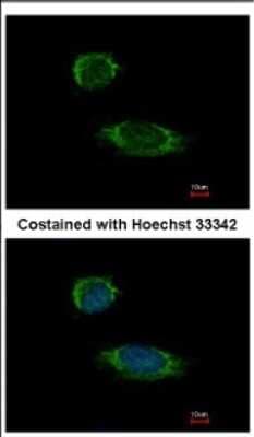 Immunocytochemistry/ Immunofluorescence: Caspase-1 Antibody [NBP2-15713]