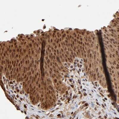 Immunohistochemistry-Paraffin: Caspase-1 Antibody [NBP1-87680]