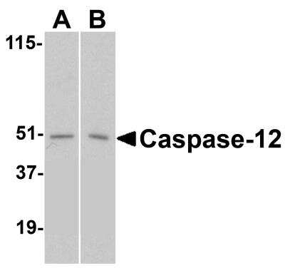 Western Blot: Caspase-12 AntibodyBSA Free [NBP2-31179]