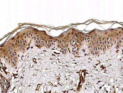 Immunohistochemistry-Paraffin: Caspase-14 Antibody (101) [NBP2-90006]