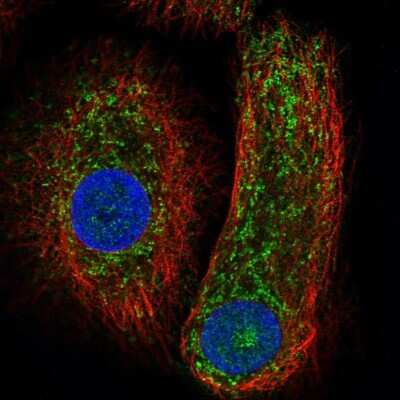 Immunocytochemistry/ Immunofluorescence: Caspase-14 Antibody [NBP2-33906]