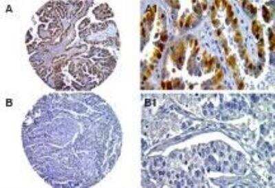 Immunohistochemistry-Paraffin: Caspase-14 Antibody [NB100-56126]