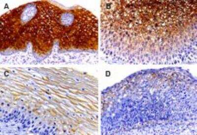 Immunohistochemistry-Paraffin: Caspase-14 Antibody [NB100-56126]