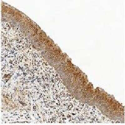 Immunohistochemical Analysis of Caspase-3 in Paraffin Embedded Human Bladder