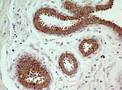 Immunohistochemistry-Paraffin: Caspase-3 Antibody (31A893) - BSA Free [NB100-56709]
