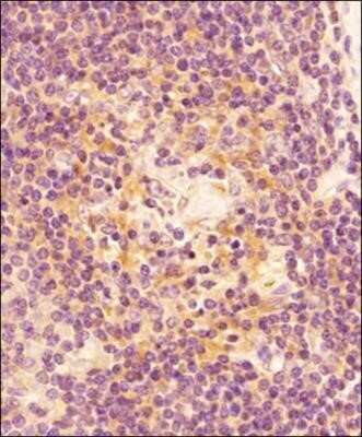 Immunohistochemistry: Caspase-3 Antibody (CPP32 4-1-18) - Azide and BSA Free [NBP2-80614]