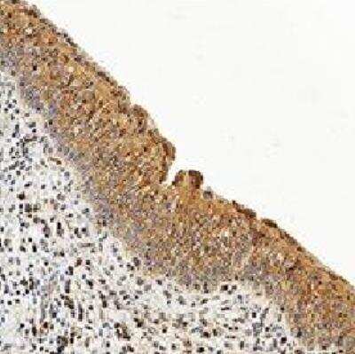 Immunohistochemistry-Paraffin: Caspase-3 Antibody (CPP32 4-1-18) - BSA Free [NB500-210]