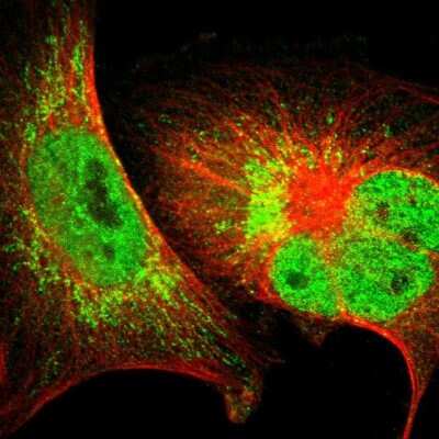 Immunocytochemistry/ Immunofluorescence: Caspase-3 Antibody [NBP1-90125]