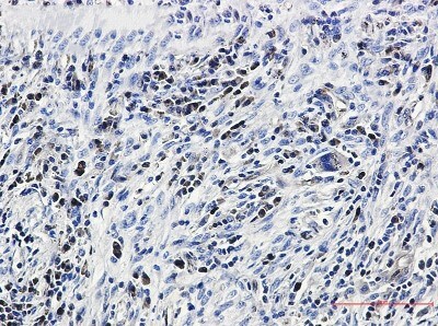 Immunohistochemistry-Paraffin: Caspase-3 Antibody (S02-7C2) [NBP3-20021]