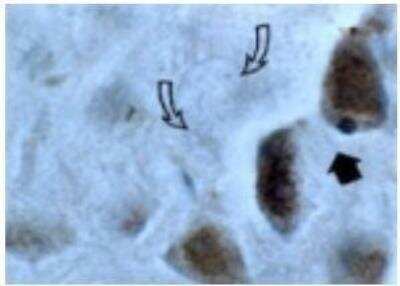 Immunohistochemistry-Paraffin: Caspase-3 Antibody - (active/cleaved) [NB100-56113]