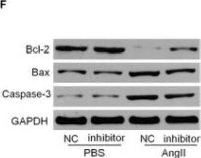 Western Blot: Caspase-3 Antibody(active/cleaved) [NB100-56113]