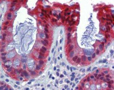 Immunohistochemistry: Caspase-7 Antibody (10-1-62) [NBP1-19230]