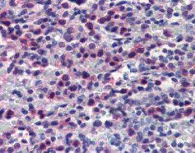 Immunohistochemistry: Caspase-7 Antibody (10-1-62) [NBP1-19230]