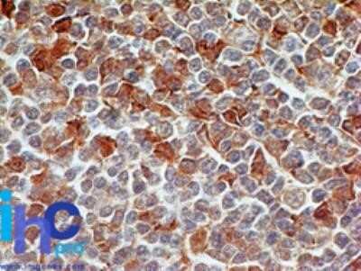Immunohistochemistry: Caspase-7 Antibody (25B881.1) - Azide and BSA Free [NBP2-80615]