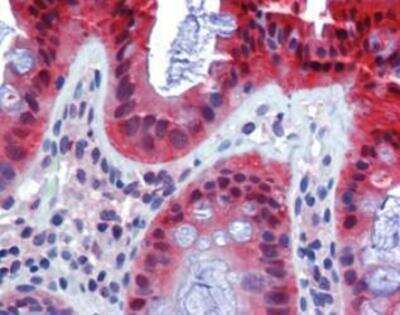 Immunohistochemistry: Caspase-7 Antibody (7-1-11) [NBP1-19229]