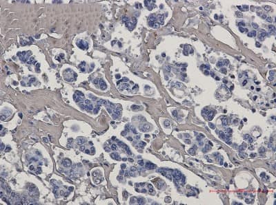Immunohistochemistry-Paraffin: Caspase-7 Antibody (S03-0F2) [NBP3-14866]