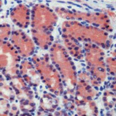 Immunohistochemistry: Caspase-8 Antibody [NB600-576]