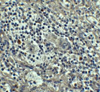 Immunohistochemistry: Caspase-8 Antibody - BSA Free [NBP1-76610]