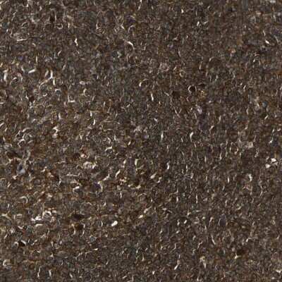 Immunohistochemistry-Paraffin: Caspase-8 Antibody [NBP1-88184]