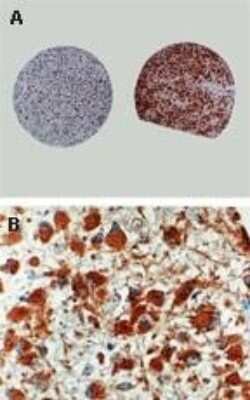 Immunohistochemistry-Paraffin: Caspase-8 Antibody [NB100-56116]