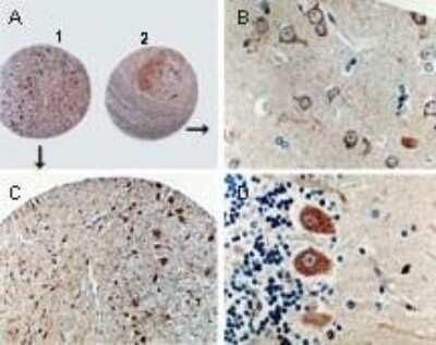 Immunohistochemistry-Paraffin: Caspase-8 Antibody [NB100-56116]