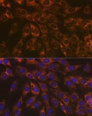Immunocytochemistry/ Immunofluorescence: Caspase-9 Antibody (9M6N2) [NBP3-15590]