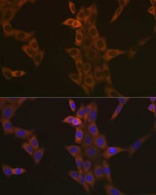 Immunocytochemistry/ Immunofluorescence: Caspase-9 Antibody (9M6N2) [NBP3-15590]