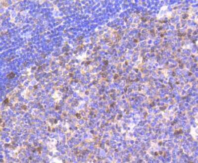 Immunohistochemistry-Paraffin: Caspase-9 Antibody (SZ29-01) - (Pro and Active) [NBP2-67362]