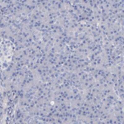 Immunohistochemistry-Paraffin: Caspr2 Antibody [NBP1-88182]