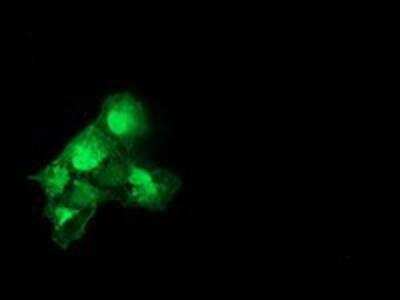 Immunocytochemistry/ Immunofluorescence: Catalase Antibody (OTI1B8) [NBP2-00492]