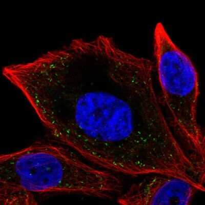 Immunocytochemistry/ Immunofluorescence: Catalase Antibody [NBP2-38772]
